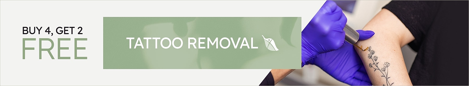 Tattoo removal promotion with buy four, get two free.
