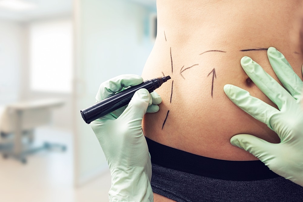 The Science Behind Body Contouring: How It Works and What to Expect