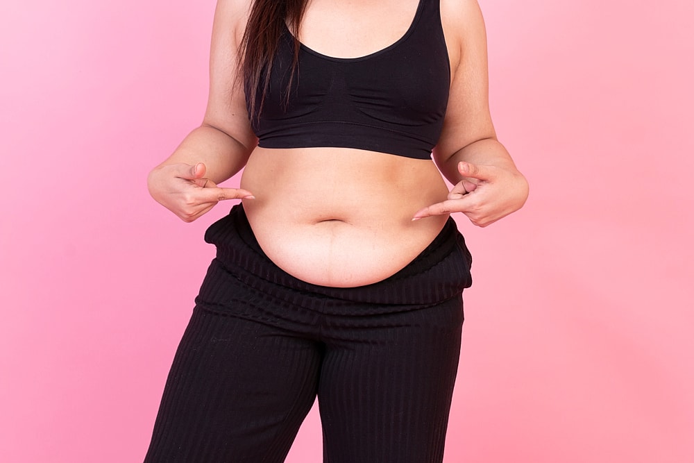 Tips for Speeding Up Your CoolSculpting® Results