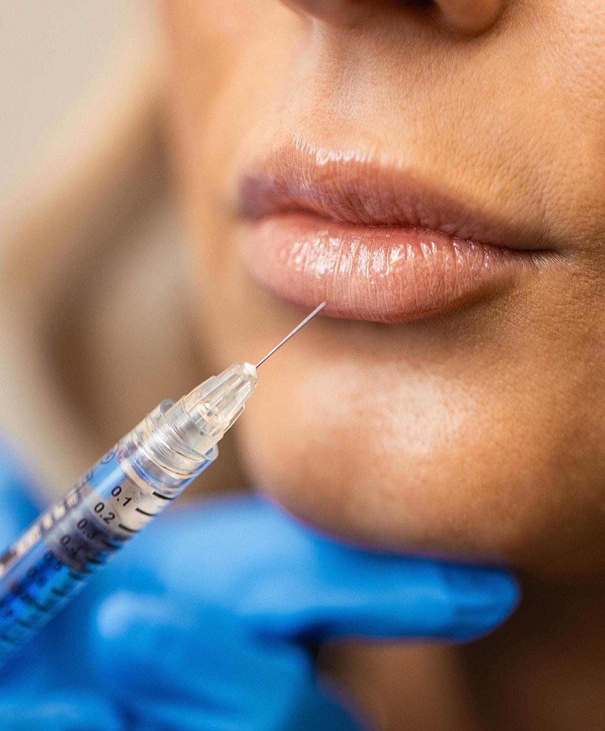 Dermal Fillers Franklin, TN
