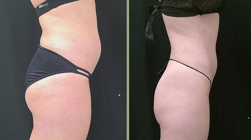 Weight Management Before & After Image